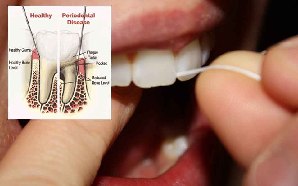 Your heart and pancreas will thank you if you brush and floss