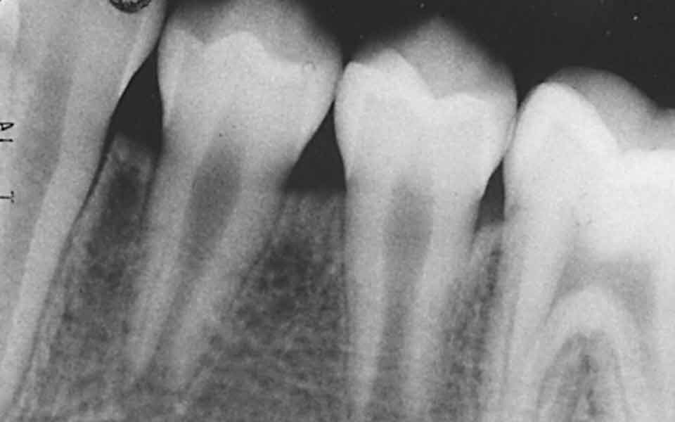 Digital X-Ray Technology